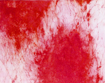 2009_DMimg
